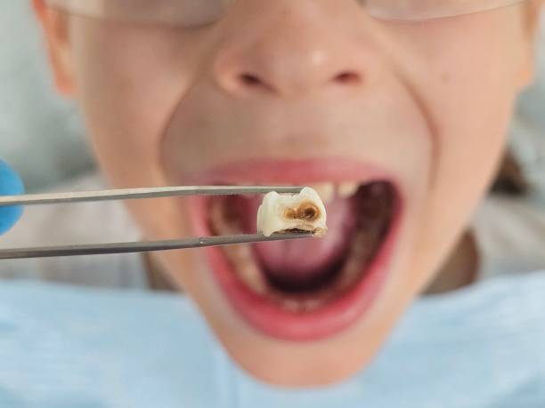 Best Pediatric Emergency Dentist in Tuckerton, NJ